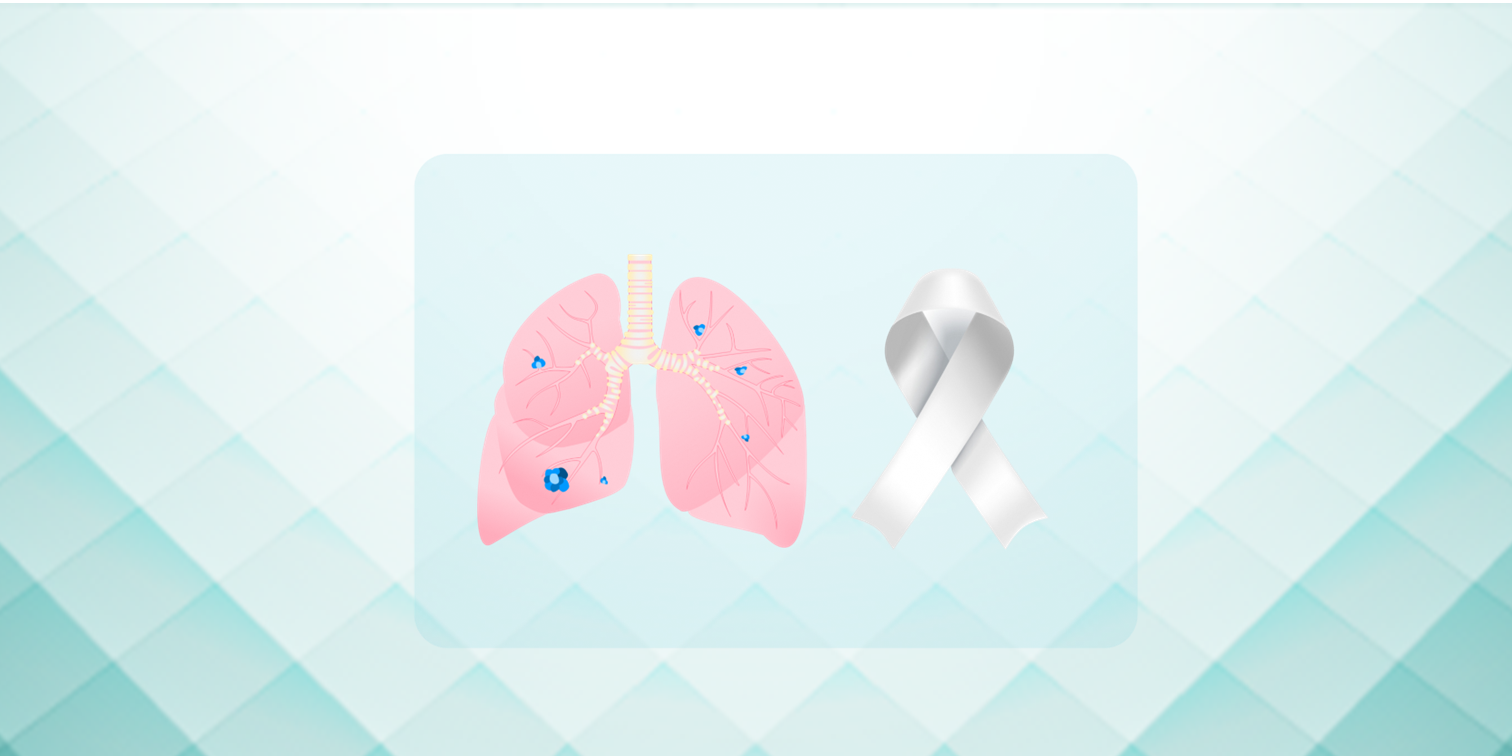 Cover image of Immunotherapies for advanced non-small-cell lung cancer